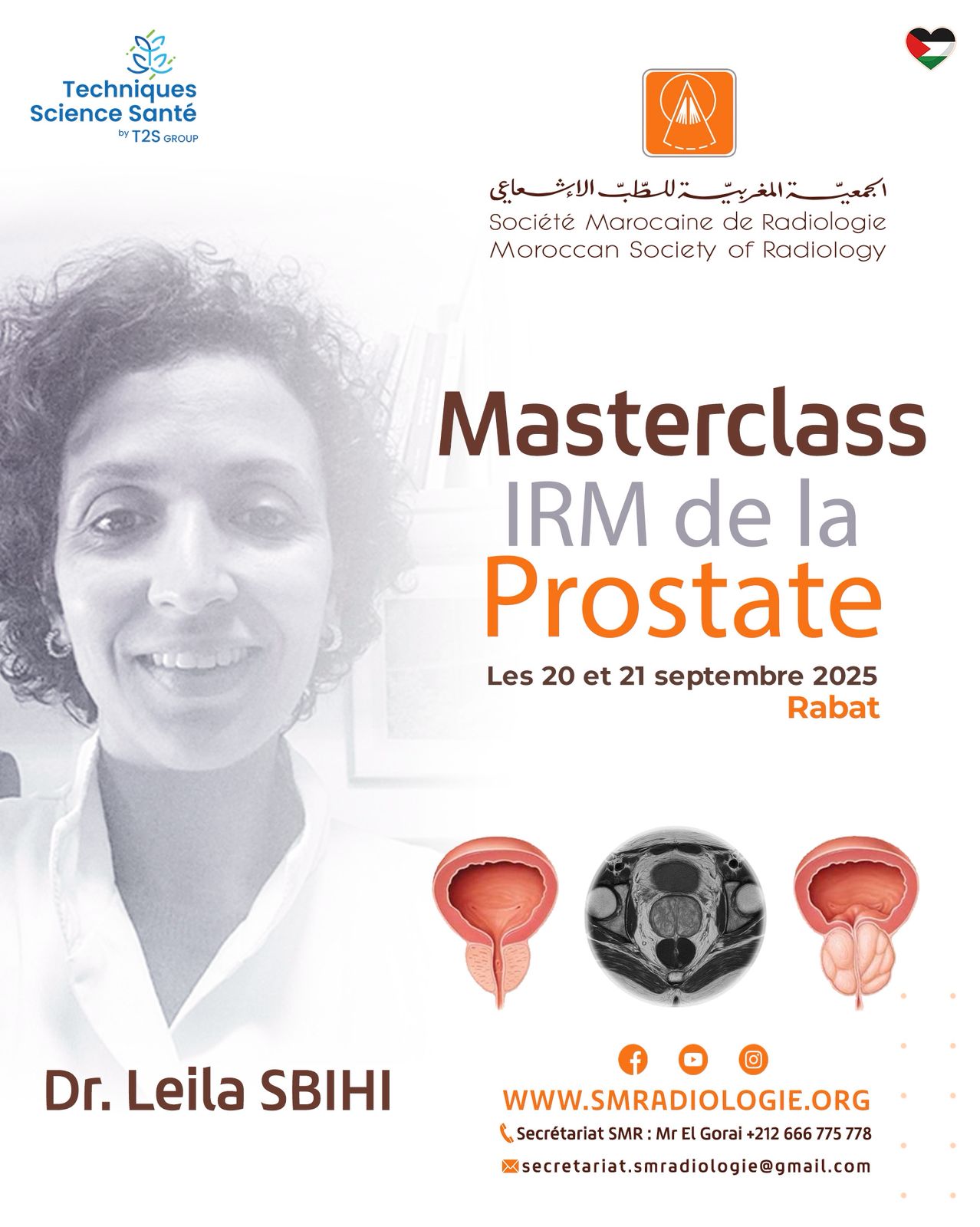 MASTERCLASS IRM DE LA PROSTATE