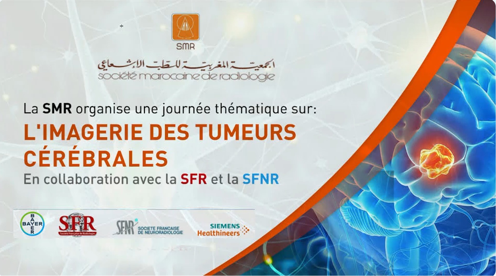 IMAGERIE DES TUMEURS CEREBRALES